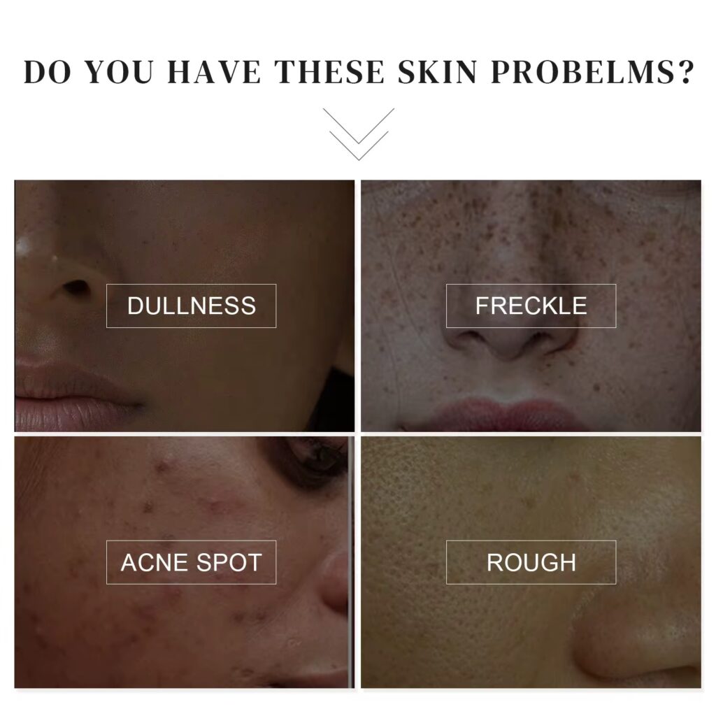 MiuRous Whitening Cream