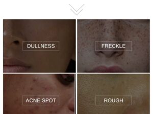 MiuRous Whitening Cream