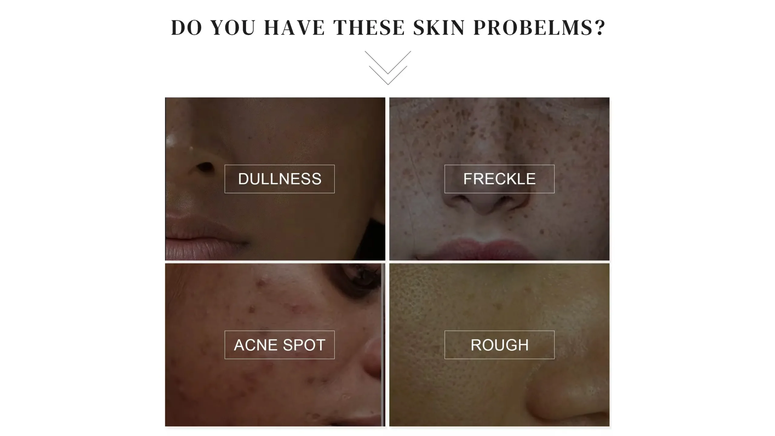 Miurous Whitening Cream - Image 2